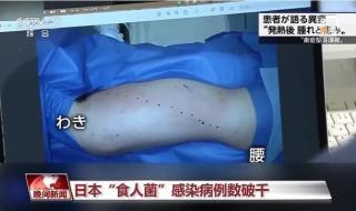 中国有食人菌吗现在